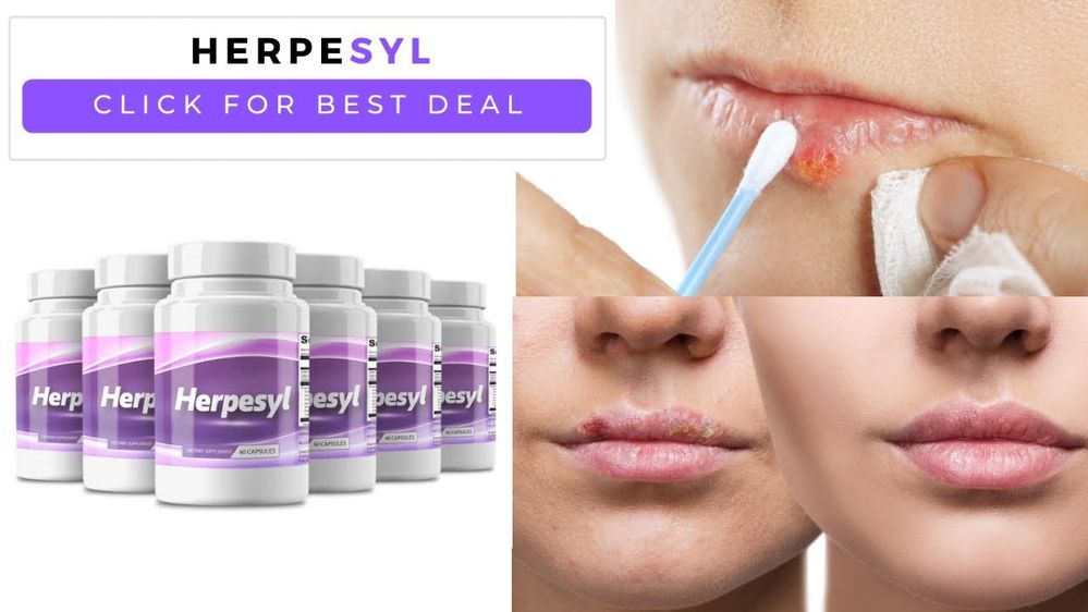 Herpesyl Review 2025: A Promising Natural Solution for Herpes Management 1 Herpesyl